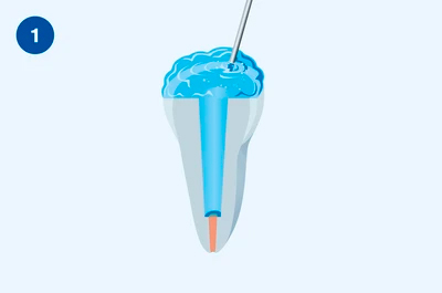 Применение Люксакор Z Дуал Смартмикс - этап 1